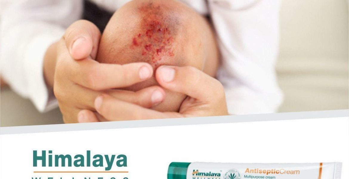 Why Himalaya Antiseptic Cream Belongs in Every Home